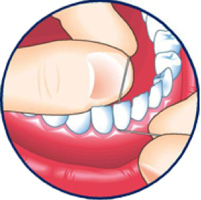 clinique-dentaire-dre-marie-claude-denis-soie-dentaire-4